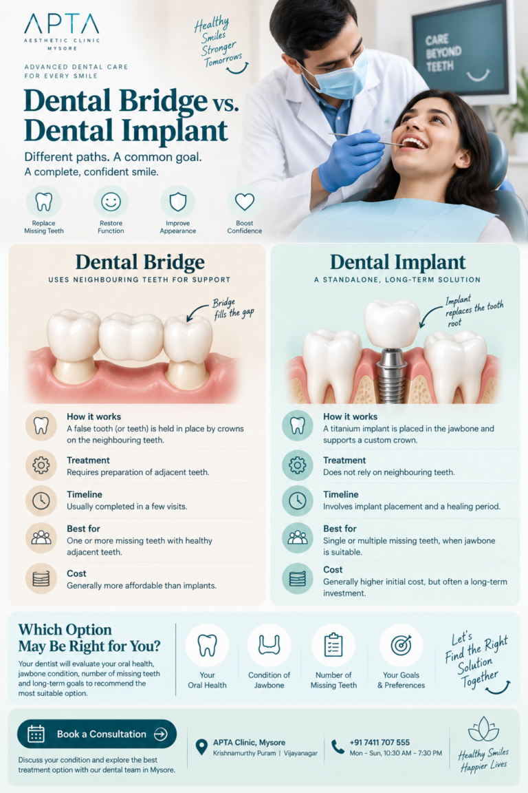 An APTA Clinic Mysore infographic titled “Dental Bridge vs. Dental Implant,” set against a bright, modern dental clinic background featuring a masked dentist examining a smiling patient. Two comparison panels explain how a dental bridge uses neighbouring teeth for support, while a dental implant is placed in the jawbone to support a custom crown. Detailed tooth and jaw illustrations, soft beige and mint-green panels, and simple icons highlight treatment methods, timelines, suitability, and cost. The lower sections feature factors to discuss with a dentist, a “Book a Consultation” button, clinic contact details, and a healthy-smile theme.
