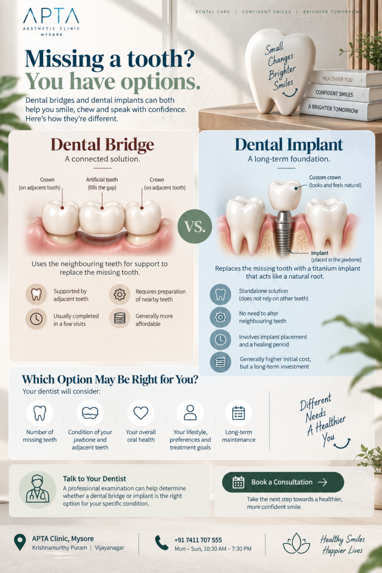 An APTA Clinic Mysore infographic titled “Missing a Tooth? You Have Options,” set against a bright, modern dental clinic background with a wooden shelf, decorative plants, and a tooth-shaped ornament. The central comparison features a dental bridge supported by neighbouring teeth and a dental implant placed in the jawbone, explaining their differences in support, treatment visits, maintenance, and cost. Soft beige and pale blue panels, detailed dental illustrations, and simple icons highlight factors such as missing teeth, jawbone condition, oral health, lifestyle, and long-term care. The lower section encourages patients to consult a dentist and includes a “Book a Consultation” button, clinic contact details, and the message “Healthy Smiles, Happier Lives.”