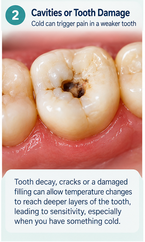 An educational dental infographic titled “Cavities or Tooth Damage” explains how cold can trigger pain in a weakened tooth. A close-up of molars shows a dark cavity and damaged tooth surface, set against a soft mint-green background with a warm pink and coral gum area. The heading features a teal numbered circle and clear navy typography, while the lower pale panel explains that decay, cracks, or a damaged filling can allow temperature changes to reach deeper tooth layers. The clean layout highlights tooth sensitivity, especially when consuming cold foods or drinks.